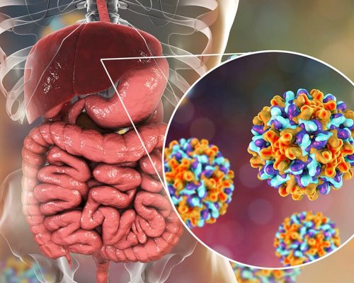 Hepatitt B - Symptomer og behandling