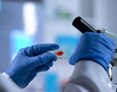 HIV - Symptomer og behandling