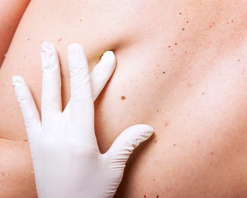 Bestill time hos hudlege