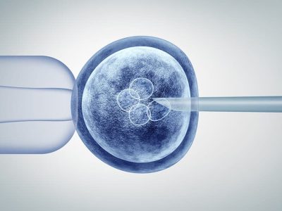 IVF-behandling - Ultralyd - Gynekolog